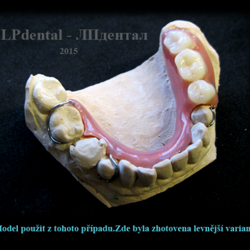 9 Ukázkové práce z polyamidu Deflex M10 (Nuxen S.r.l.) pro firmu Complete Dental.png