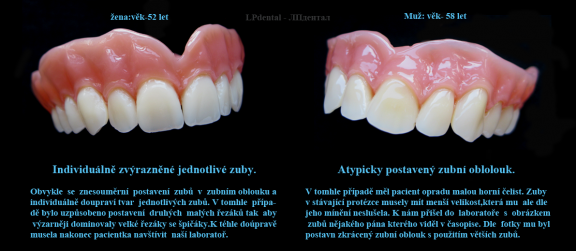 20 Možnosti v postavení zubů LPdental.png