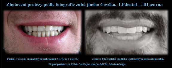 4 Srovnání nových náhrad v ústech s použitou fotografickou předlohou..png