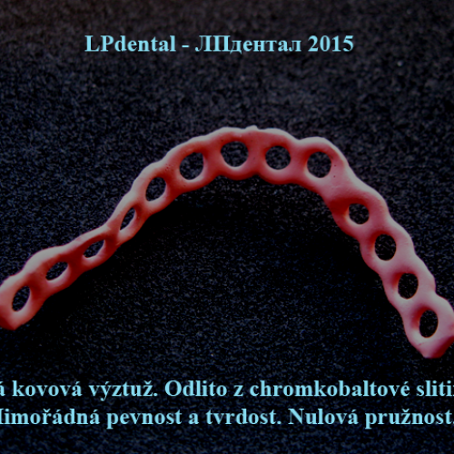 1 Litá chromkobaltová výztuž..png