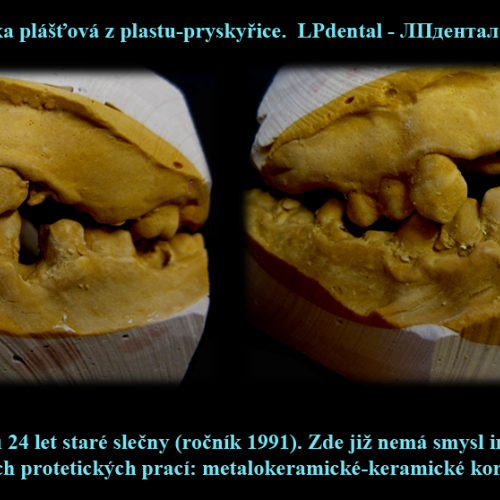 6 Korunka plášťová z plastu-pryskyřice.png.png