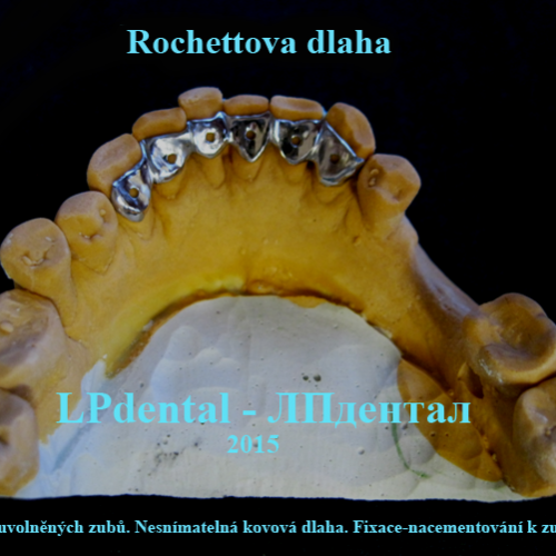 05 Rochettova dlaha.png