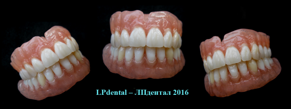 Pohled na detaily individuálně zhotovených náhrad..png