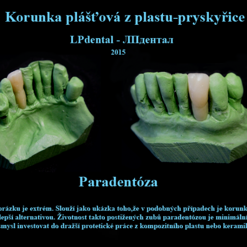 2 Korunka plášťová z plastu-pryskyřice..png