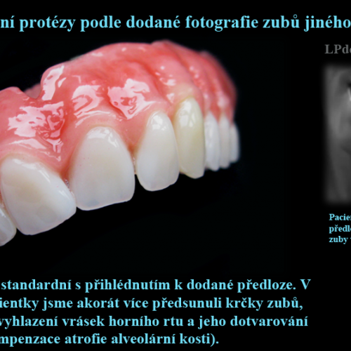 2 Zhotovení protézy podle fotografie zubů jiného člověka..png