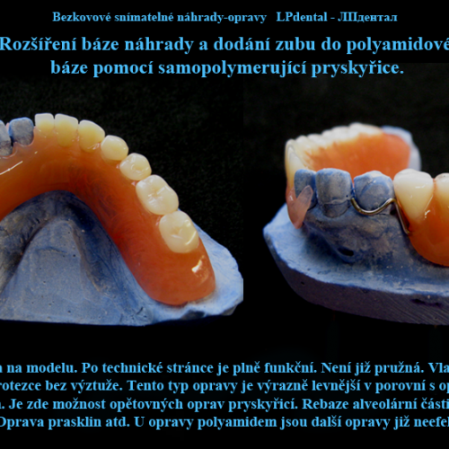 10 Dodání zubu a rozšíření báze pomocí samopolymerující pryskyřice..png