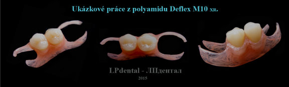 13 Ukázkové práce z polyamidu Deflex M10 (Nuxen S.r.l.) pro firmu Complete Dental.png