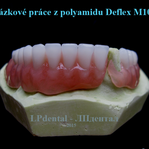 21 Ukázkové práce z polyamidu Deflex M10 (Nuxen S.r.l.) pro firmu Complete Dental.png
