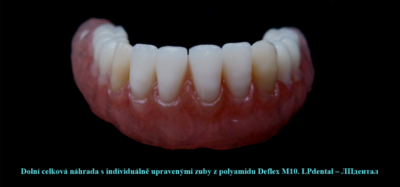 Celková náhrada dolní z Deflexu M10..png