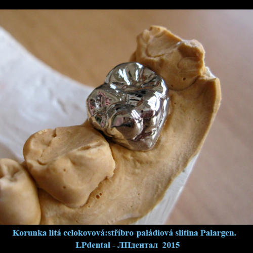 7 Korunka litá celokovová-stříbrné slitiny-Palargen.png