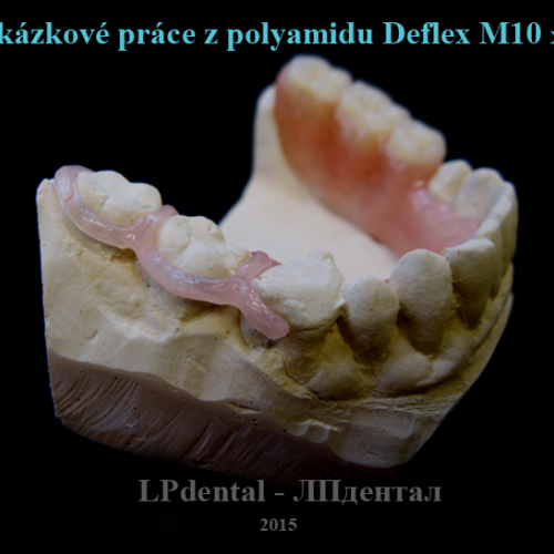 11 Ukázkové práce z polyamidu Deflex M10 (Nuxen S.r.l.) pro firmu Complete Dental.png