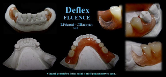 Deflex Fluence 3.png