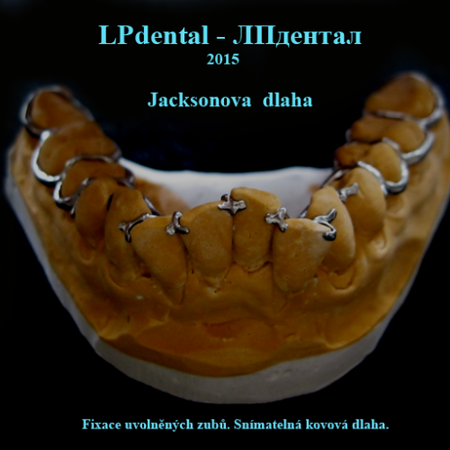 04 Jacksonova dlaha.png
