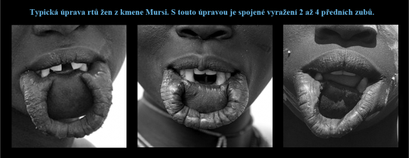 3 Úprava rtů a zubů u žen z kmene Mursi..png