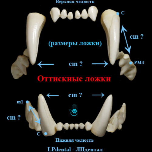 1 Оттискные ложки (размеры  ложки)-LPdental -ЛПдентал.png