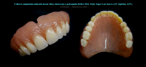 4 Protruze (Protrusion) zhotovení protézy podle starší fotografie s původním postavením zubů..png
