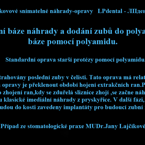 21 Dodání zubů a rozšíření báze pomocí polyamidu..png