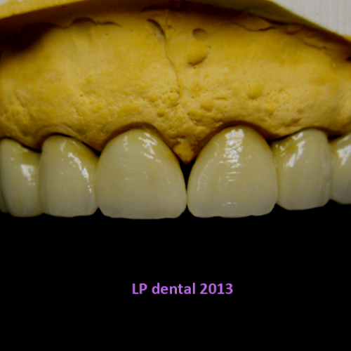 29 MUDr.Jana Lajčíková-Petr Moj-LPdental-keramika.png