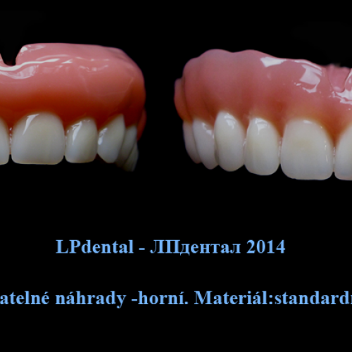 02 Celkové snímatelné náhrady-Superacryl Plus.png