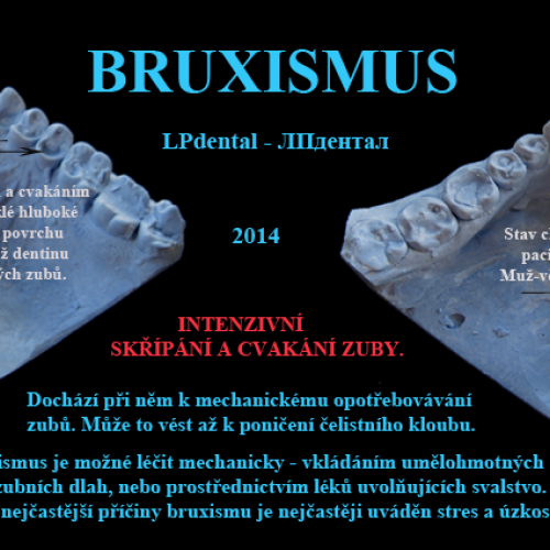 00 Dlaha proti skřípání zubů-Bruxismus..png
