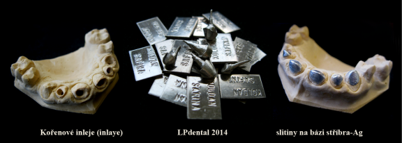 2 Inlej-Inlay-Stříbro-Silver.png