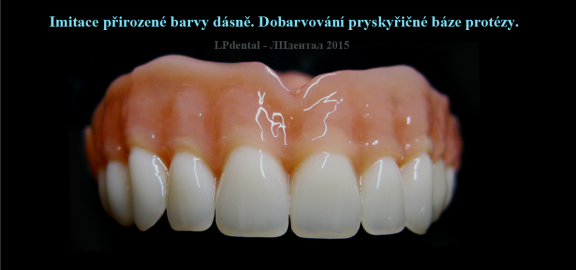  Imitace přirozené barvy dásně. Dobarvování pryskyřičné báze protézy..png