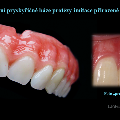 9 Dobarvování pryskyřičné báze protézy-imitace přirozené barvy dásně..png