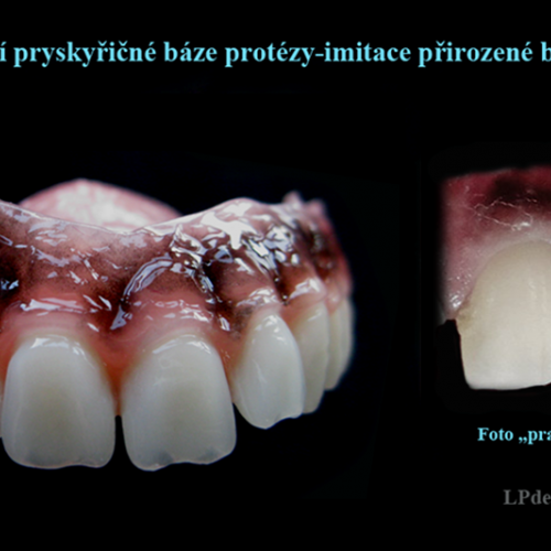 10 Dobarvování pryskyřičné báze protézy-physiologic-racial-pigmentation.png