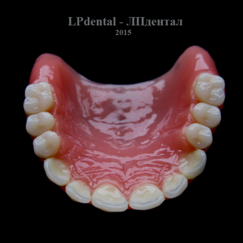 11 Ukázkové práce z pryskyřice Acry Pol-R (Ruthinium Group) pro firmu Complete Dental.png