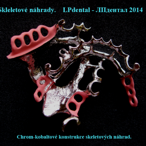 01-1 Konstrukce skeletových náhrad.png