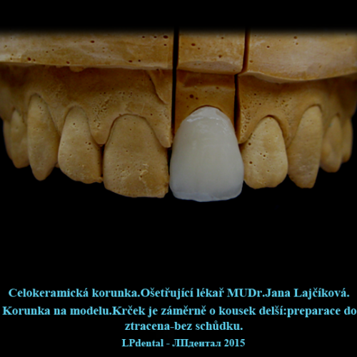 14 Korunka plášťová keramická.png