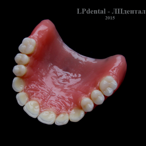 10 Ukázkové práce z pryskyřice Acry Pol-R (Ruthinium Group) pro firmu Complete Dental.png