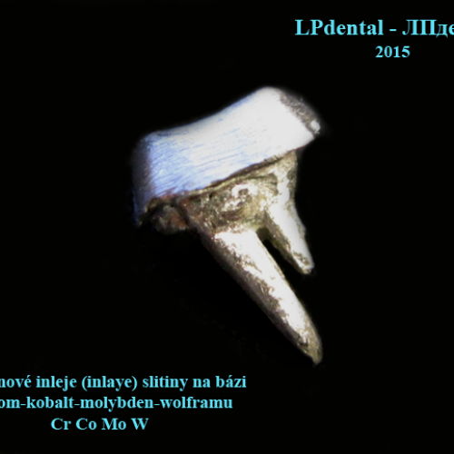 08-1  inlay kořenová 2 kanálky-nepřímá litá.png