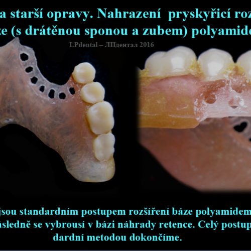 41 Oprava starší opravy.Nahrazení pryskyřicí rozšířené báze polyamidem.png