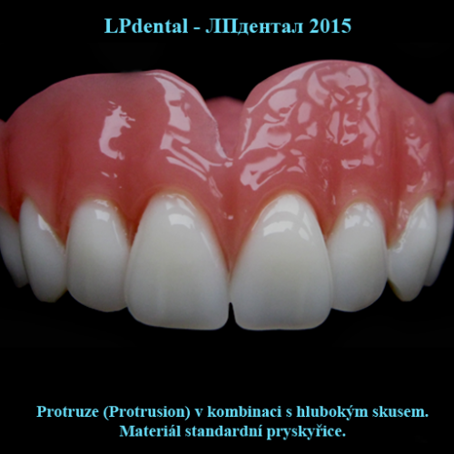 18 Totální protézy-Protruze-Hluboký skus-Acryl Pol-R.png
