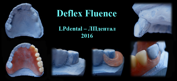 Deflex Fluence 6.png
