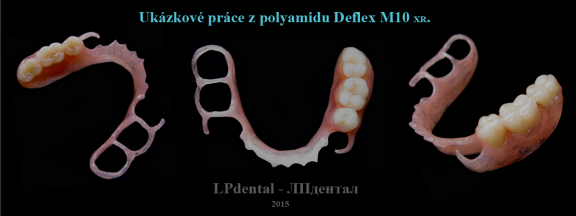 6 Ukázkové práce z polyamidu Deflex M10 (Nuxen S.r.l.) pro firmu Complete Dental.png