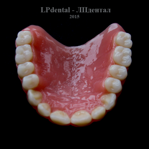 5 Ukázkové práce z pryskyřice Acry Pol-R (Ruthinium Group) pro firmu Complete Dental.png