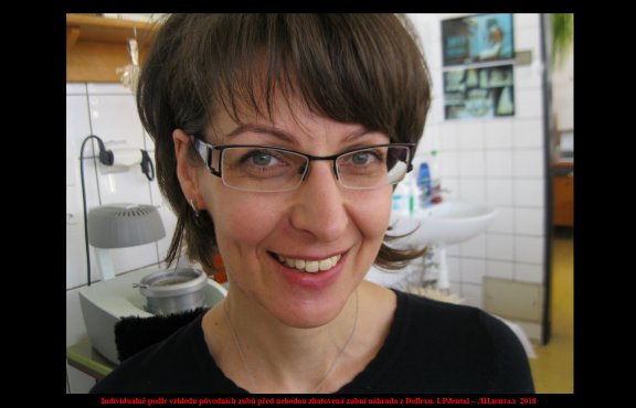 13 S novou náhradou před odchodem z laboratoře..jpg