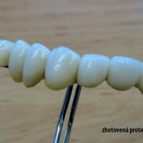 8  MUDr.Jana Lajčíková-Petr Moj- LPdental-keramika NORITAKE ノリタケ.png