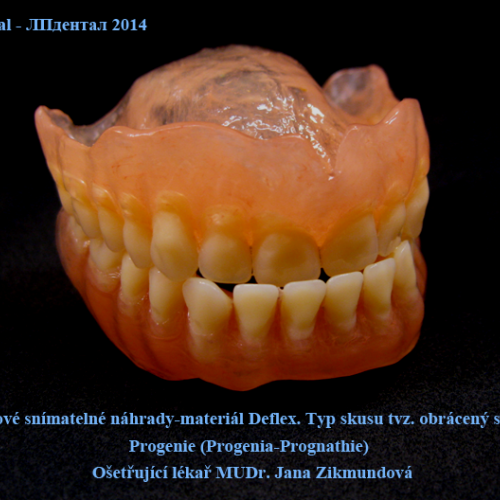 09 Totální protézy- MUDr.Jana Zikmundová-Deflex.png