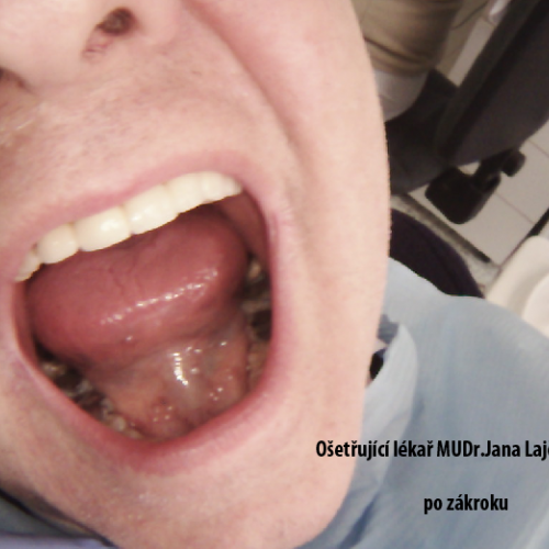12  MUDr.Jana Lajčíková-Petr Moj- LPdental-keramika NORITAKE ノリタケ.png