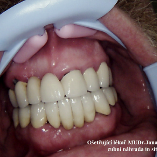 25  MUDr.Jana Lajčíková-Petr Moj-LPdental-keramika.png
