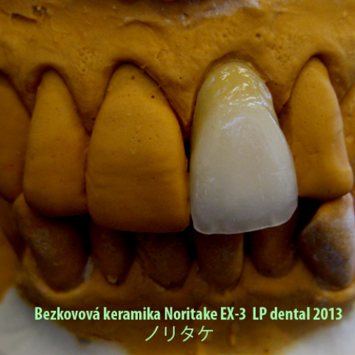 9 Korunka plášťová keramická.png
