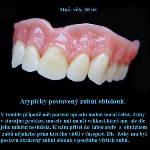 1 Atypicky postavený zubní oblouk.png