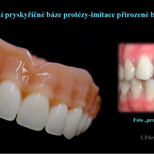 3 Dobarvování pryskyřičné báze protézy-imitace přirozené barvy dásně.png