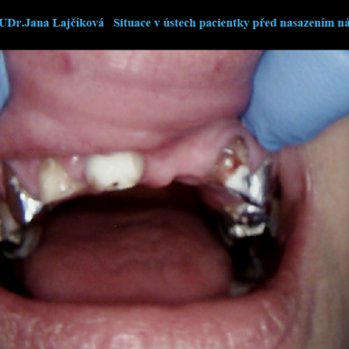 36  MUDr.Jana Lajčíková-Petr Moj-LPdental-keramika.png