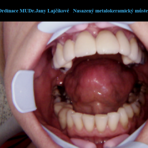 39  MUDr.Jana Lajčíková-Petr Moj-LPdental-keramika.png