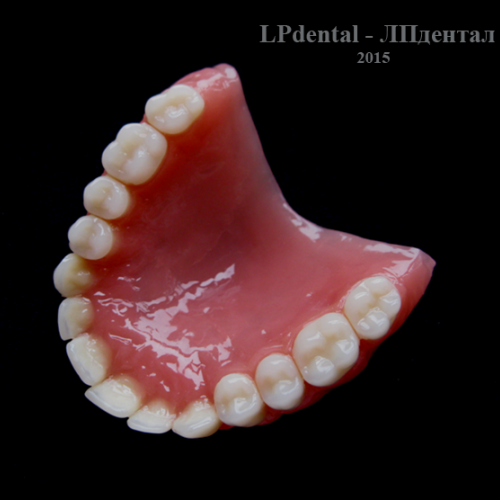 16 Ukázkové práce z pryskyřice Acry Pol-R (Ruthinium Group) pro firmu Complete Dental.png
