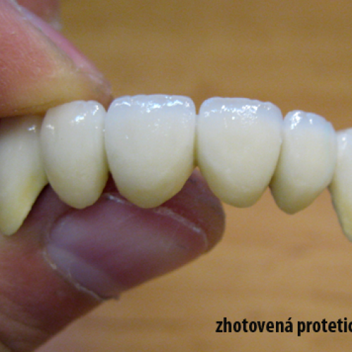 2  MUDr.Jana Lajčíková-Petr Moj- LPdental-keramika NORITAKE ノリタケ.png